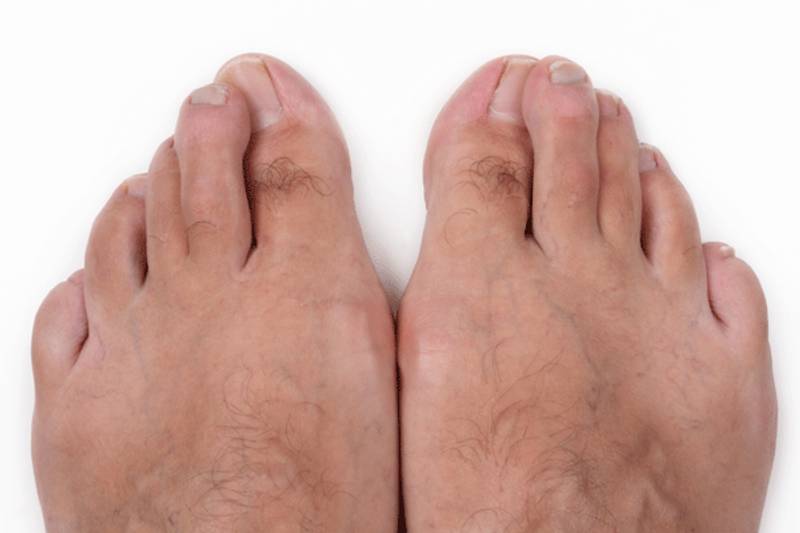 i nomi delle dita dei piedi